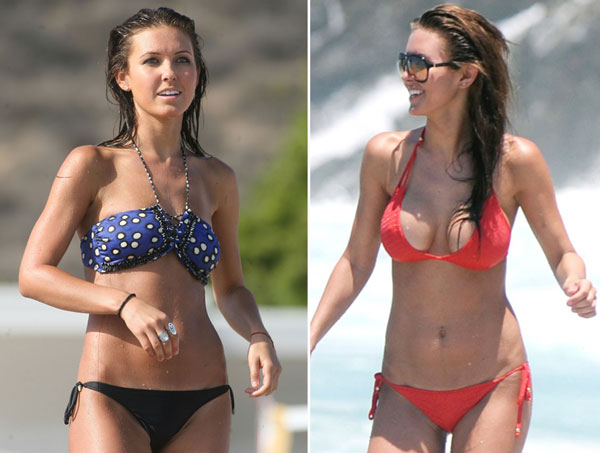Audrina-Partridge-Before-After-Breast-Augmentation